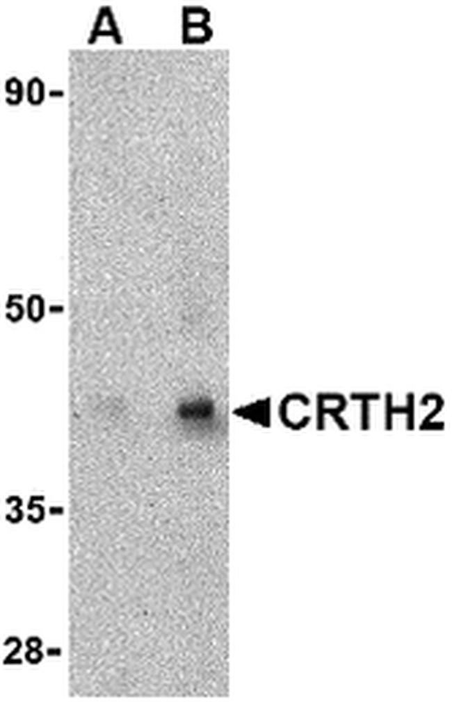 CRTH2 Antibody in Western Blot (WB)