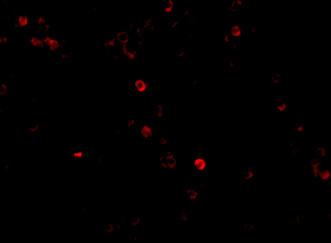 MDA5 Antibody in Immunocytochemistry (ICC/IF)