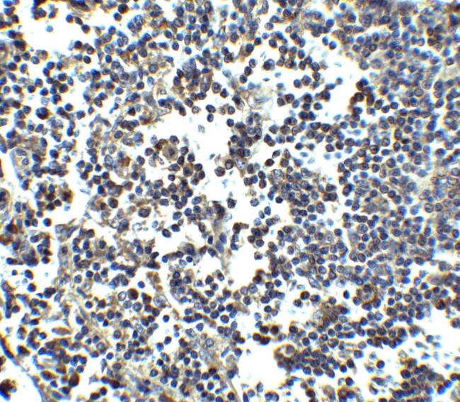 MDA5 Antibody in Immunohistochemistry (IHC)