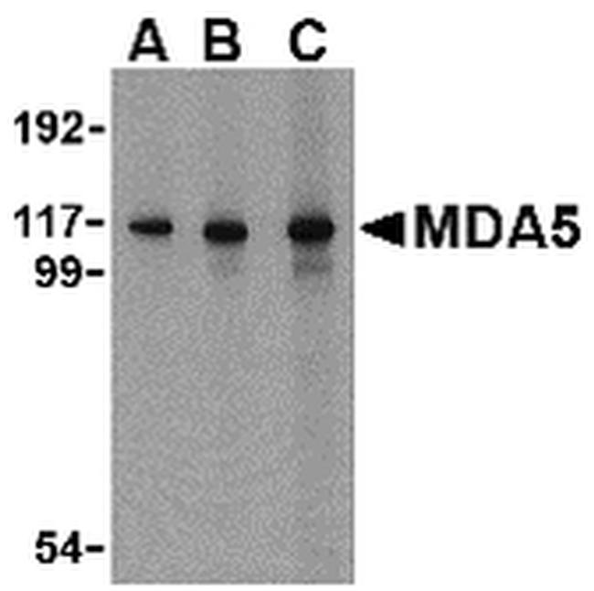 MDA5 Antibody in Western Blot (WB)