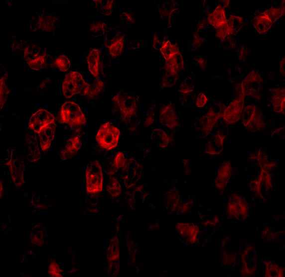 SCO2 Antibody in Immunohistochemistry (IHC)