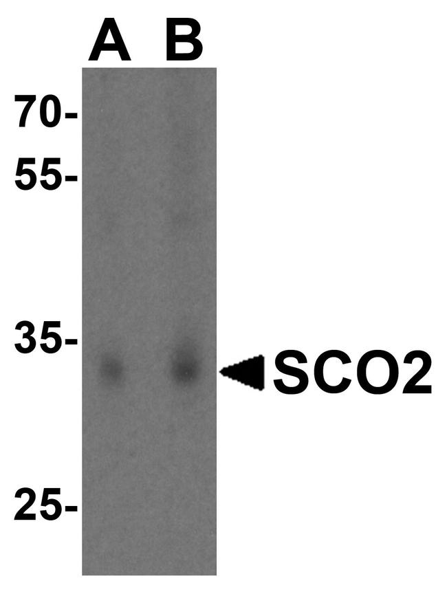 SCO2 Antibody in Western Blot (WB)