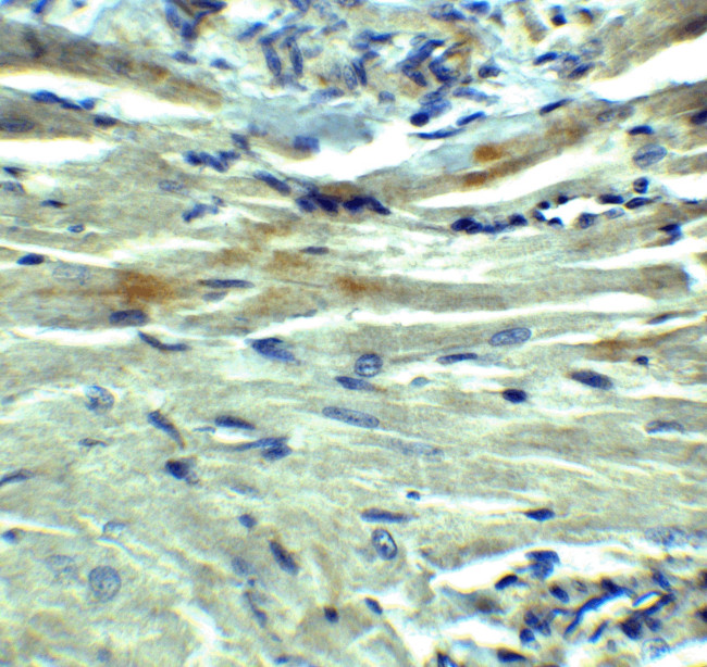 PD-L1 Antibody in Immunohistochemistry (Paraffin) (IHC (P))