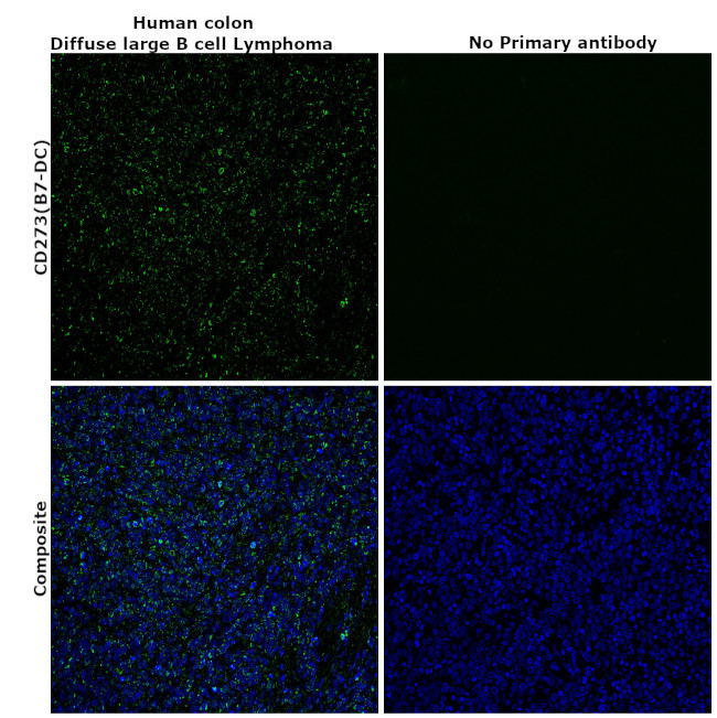 CD273 (B7-DC) Antibody in Immunohistochemistry (Paraffin) (IHC (P))