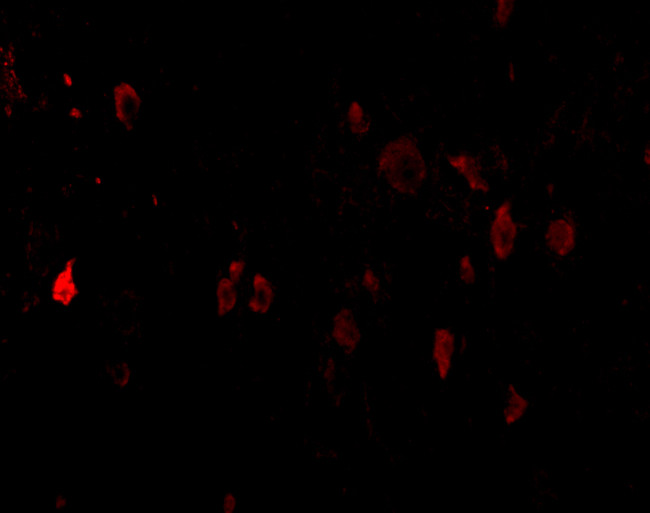 CD273 (B7-DC) Antibody in Immunohistochemistry (Paraffin) (IHC (P))