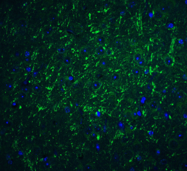 CD273 (B7-DC) Antibody in Immunohistochemistry (Paraffin) (IHC (P))