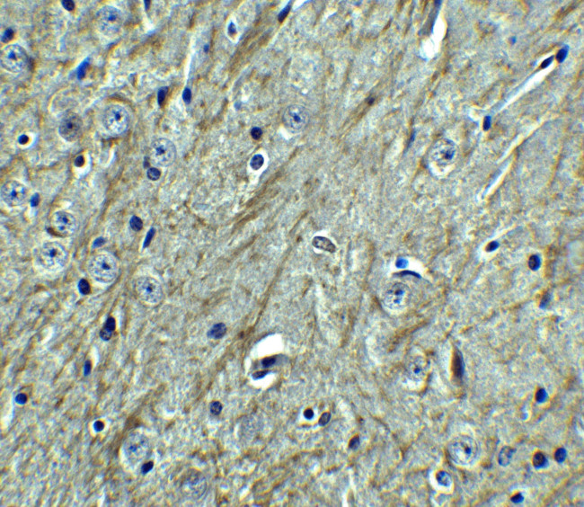 CD273 (B7-DC) Antibody in Immunohistochemistry (Paraffin) (IHC (P))