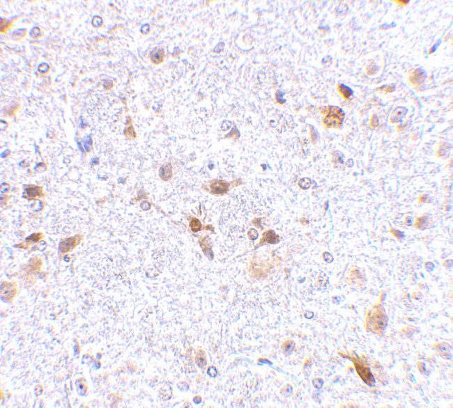 CD273 (B7-DC) Antibody in Immunohistochemistry (Paraffin) (IHC (P))