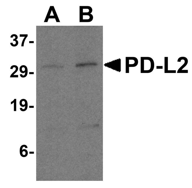 CD273 (B7-DC) Antibody in Western Blot (WB)