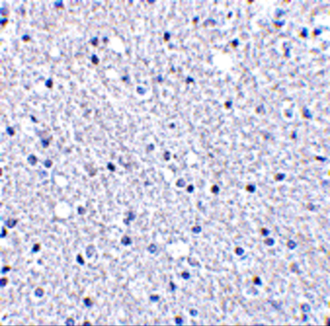 TIGAR Antibody in Immunohistochemistry (IHC)