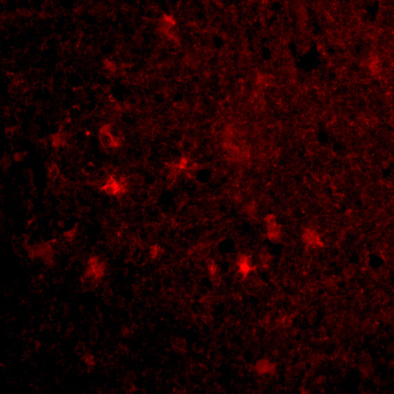 MAVS Antibody in Immunocytochemistry (ICC/IF)