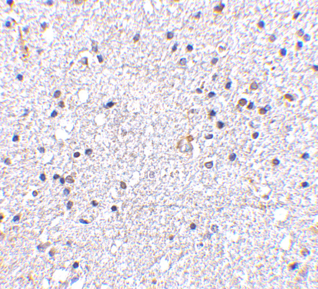 MAVS Antibody in Immunohistochemistry (IHC)