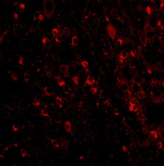 MAVS Antibody in Immunocytochemistry (ICC/IF)