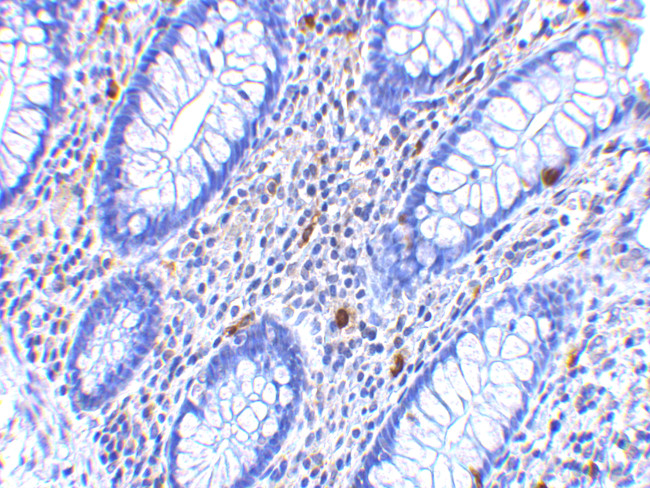 CD82 Antibody in Immunohistochemistry (IHC)