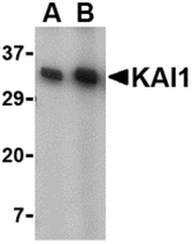 CD82 Antibody in Western Blot (WB)