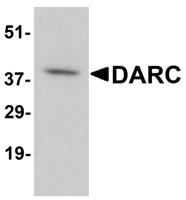 DARC Antibody in Western Blot (WB)