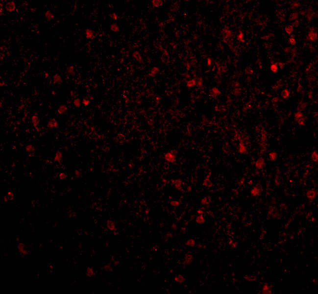 STK29 Antibody in Immunocytochemistry (ICC/IF)