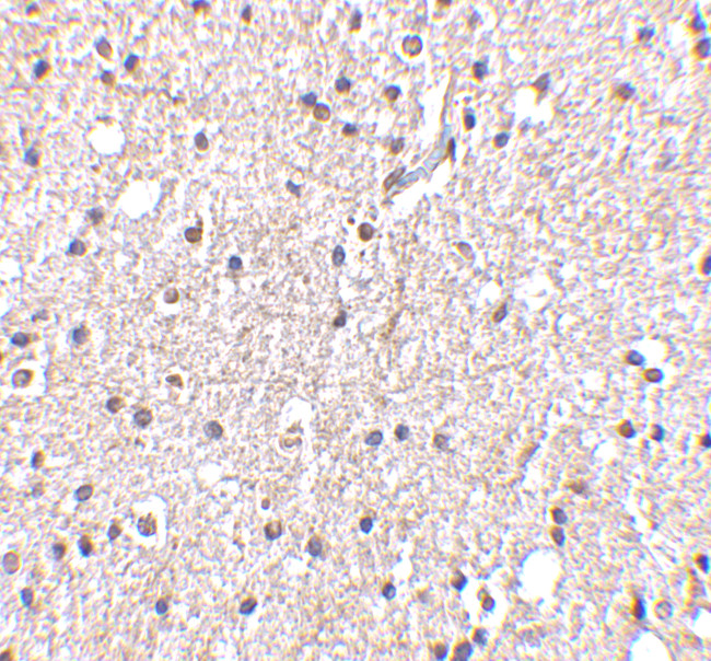 STK29 Antibody in Immunohistochemistry (IHC)