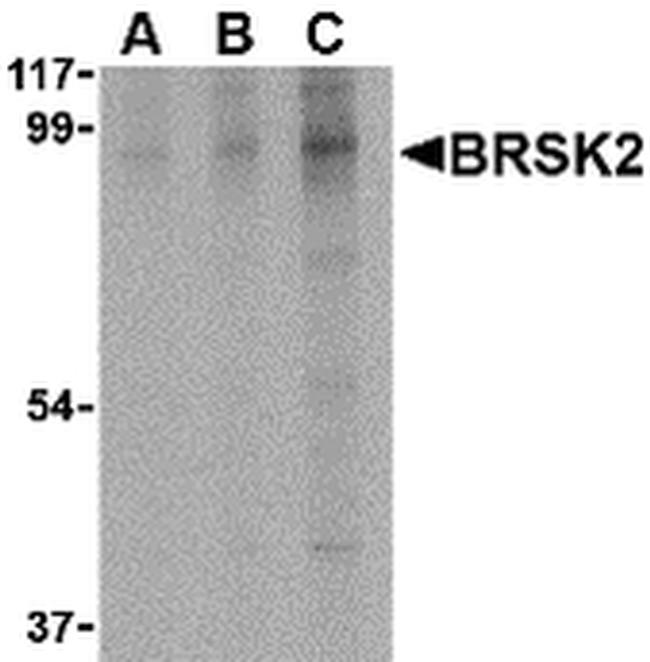 STK29 Antibody in Western Blot (WB)