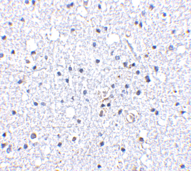 DARC Antibody in Immunohistochemistry (IHC)