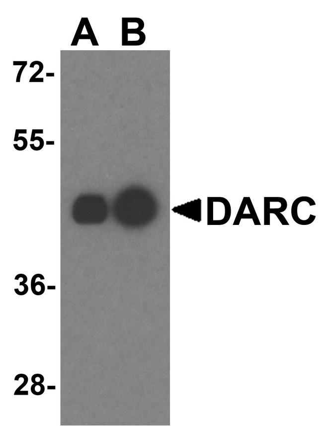 DARC Antibody in Western Blot (WB)