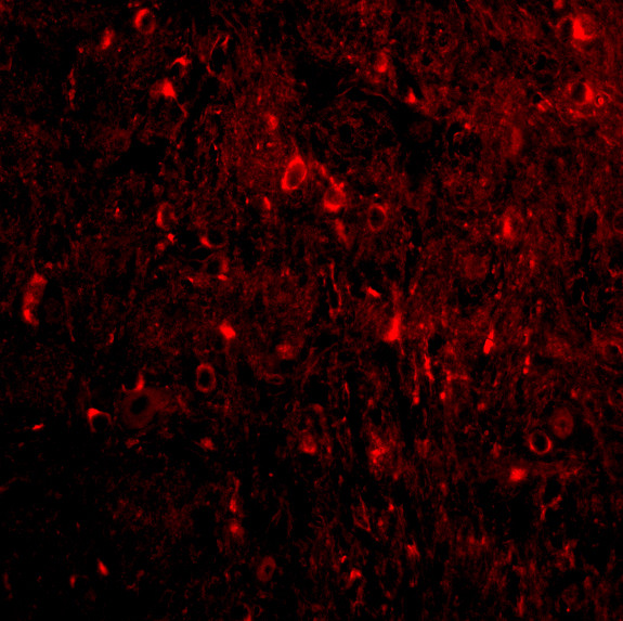 Nogo-A Antibody in Immunocytochemistry (ICC/IF)