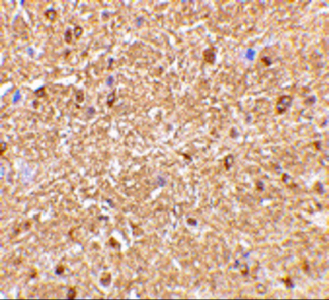 Nogo-A Antibody in Immunohistochemistry (IHC)