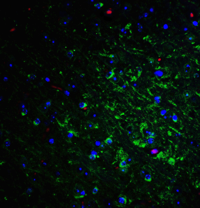 Nogo-A Antibody in Immunohistochemistry (IHC)