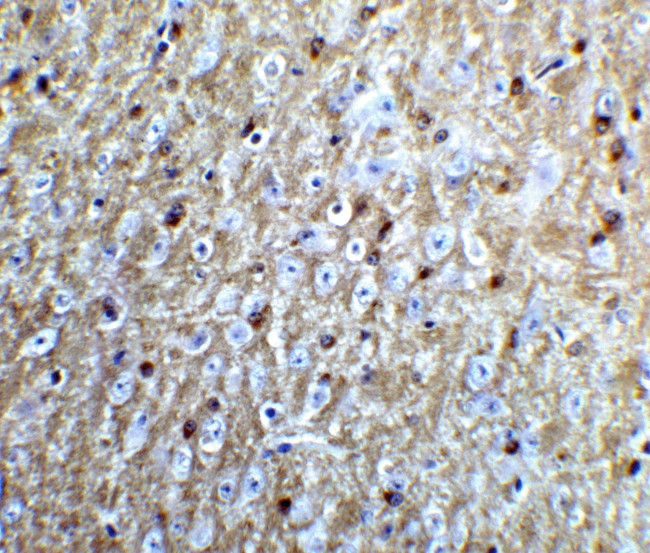 Nogo-A Antibody in Immunohistochemistry (IHC)