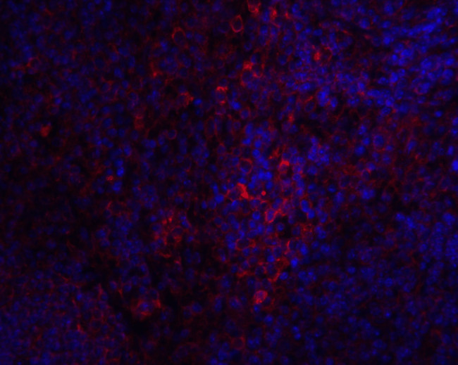 STIM1 Antibody in Immunocytochemistry (ICC/IF)