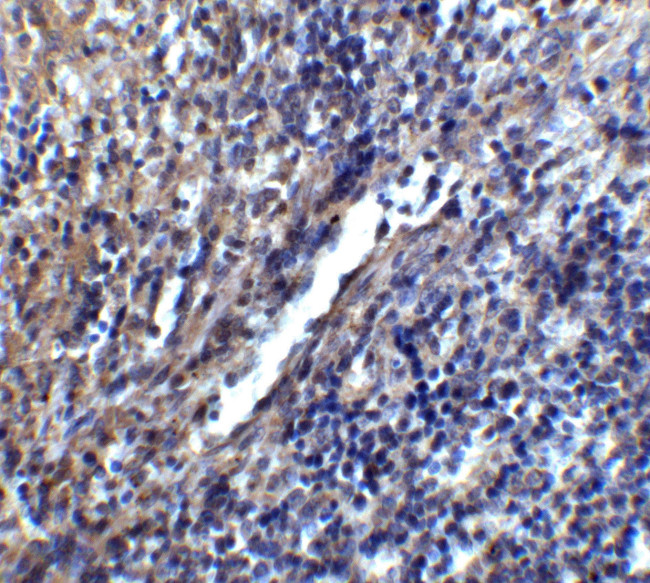 STIM1 Antibody in Immunohistochemistry (IHC)