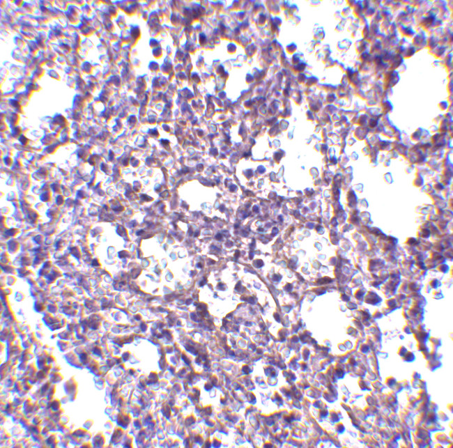 STIM2 Antibody in Immunohistochemistry (IHC)