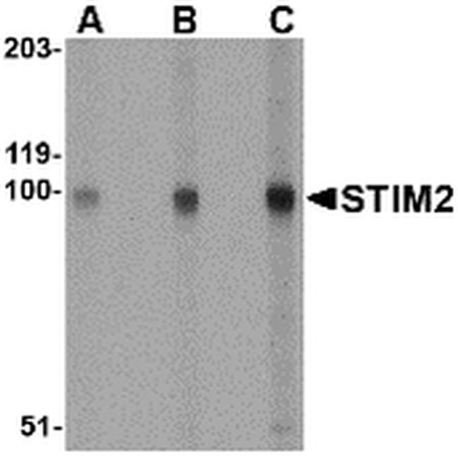 STIM2 Antibody in Western Blot (WB)