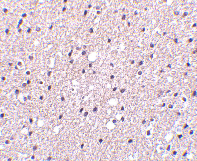 Presenilin 1 Antibody in Immunohistochemistry (IHC)