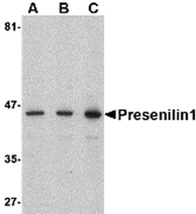 Presenilin 1 Antibody in Western Blot (WB)