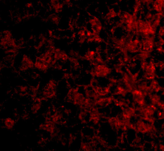 TSLP Receptor Antibody in Immunohistochemistry (IHC)