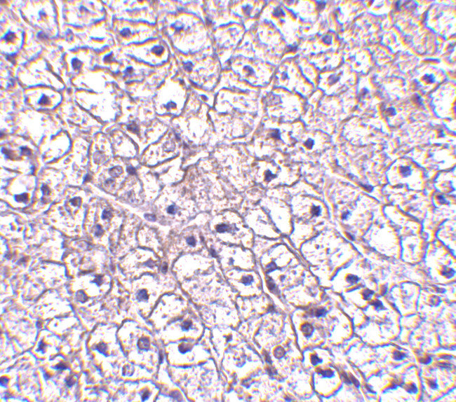 TSLP Receptor Antibody in Immunohistochemistry (IHC)