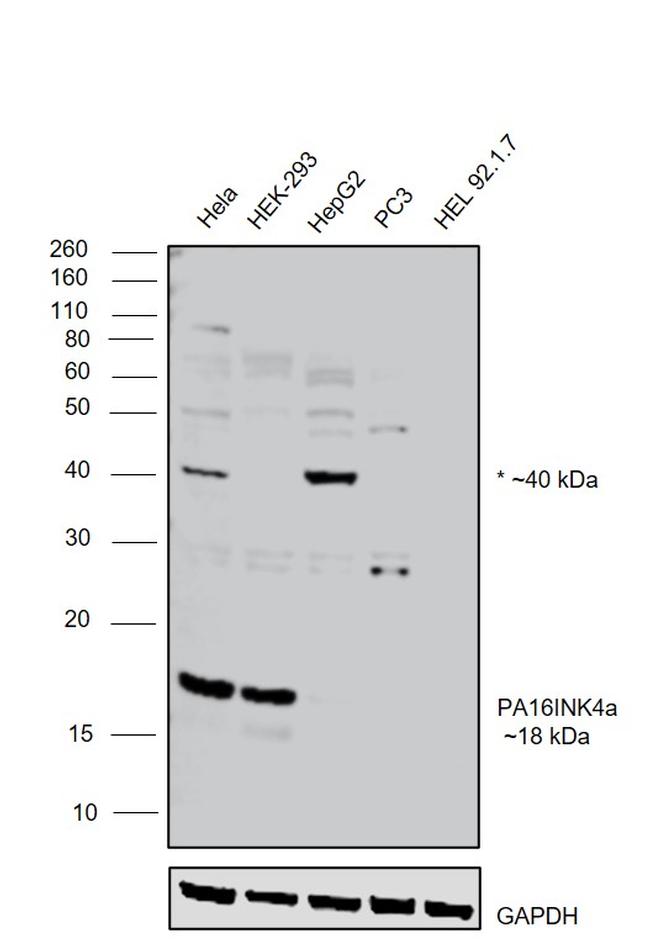 p16INK4a Antibody in Western Blot (WB)