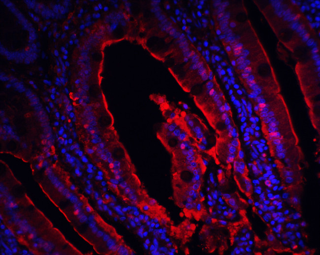 p16INK4a Antibody in Immunohistochemistry (PFA fixed) (IHC (PFA))