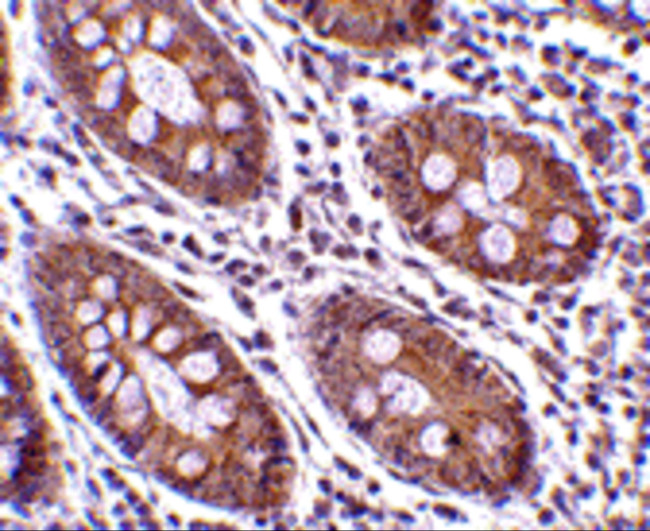 p16INK4a Antibody in Immunohistochemistry (Paraffin) (IHC (P))