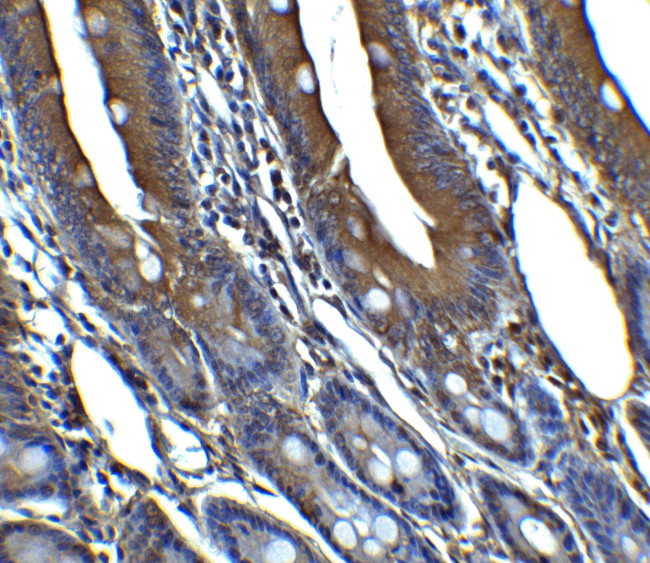 p16INK4a Antibody in Immunohistochemistry (Paraffin) (IHC (P))