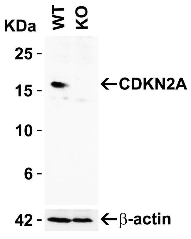 p16INK4a Antibody in Western Blot (WB)