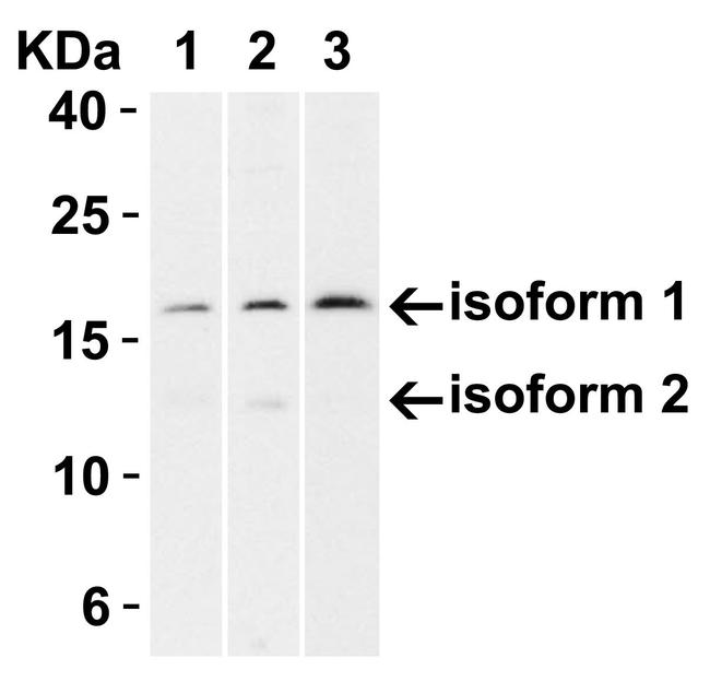 p16INK4a Antibody in Western Blot (WB)