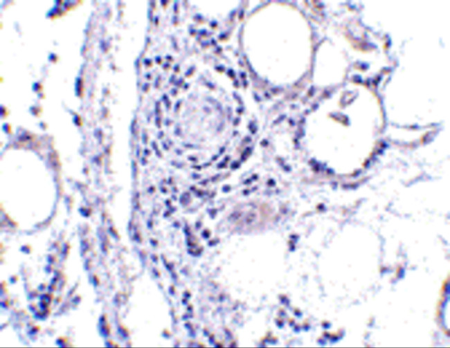 FABP7 Antibody in Immunohistochemistry (IHC)