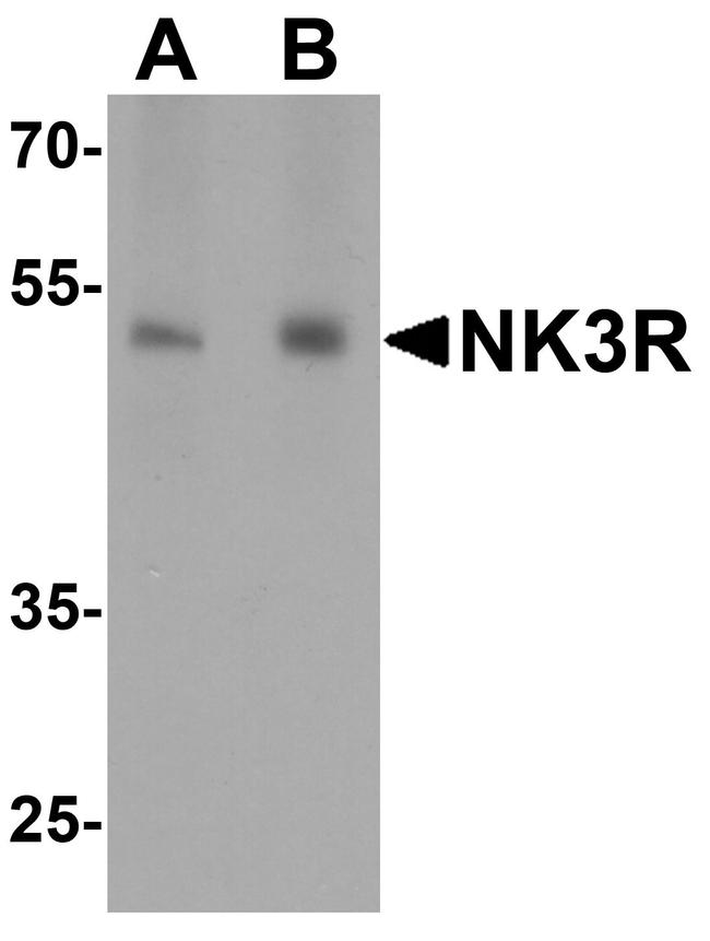 TACR3 Antibody in Western Blot (WB)