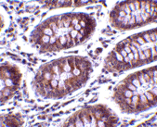 MICA Antibody in Immunohistochemistry (IHC)