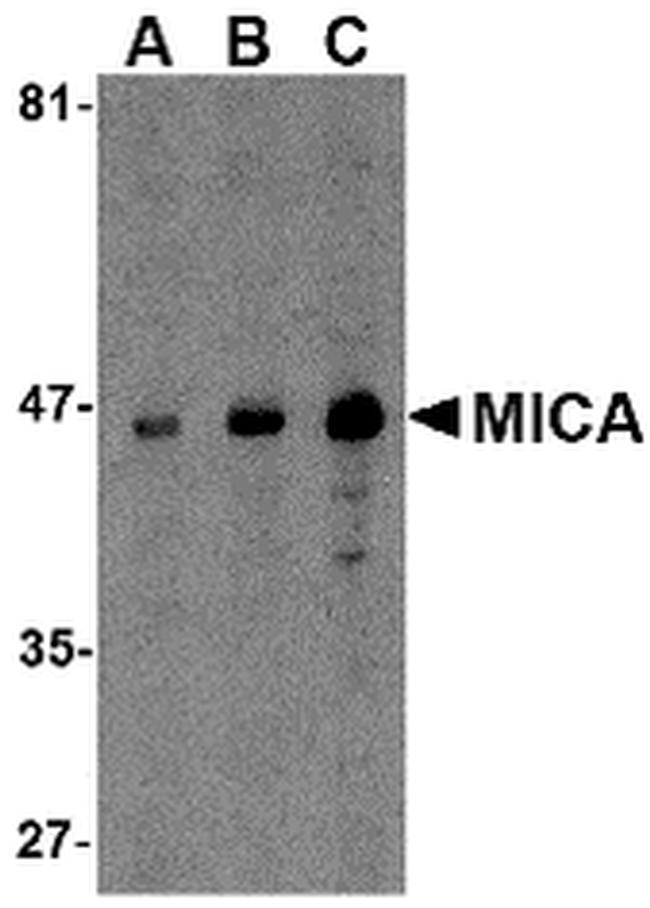 MICA Antibody in Western Blot (WB)