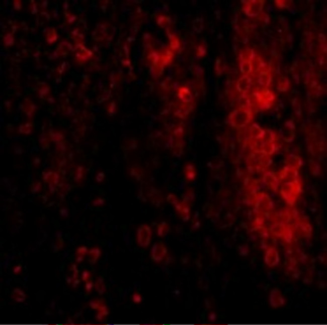 IL-33 Antibody in Immunohistochemistry (IHC)