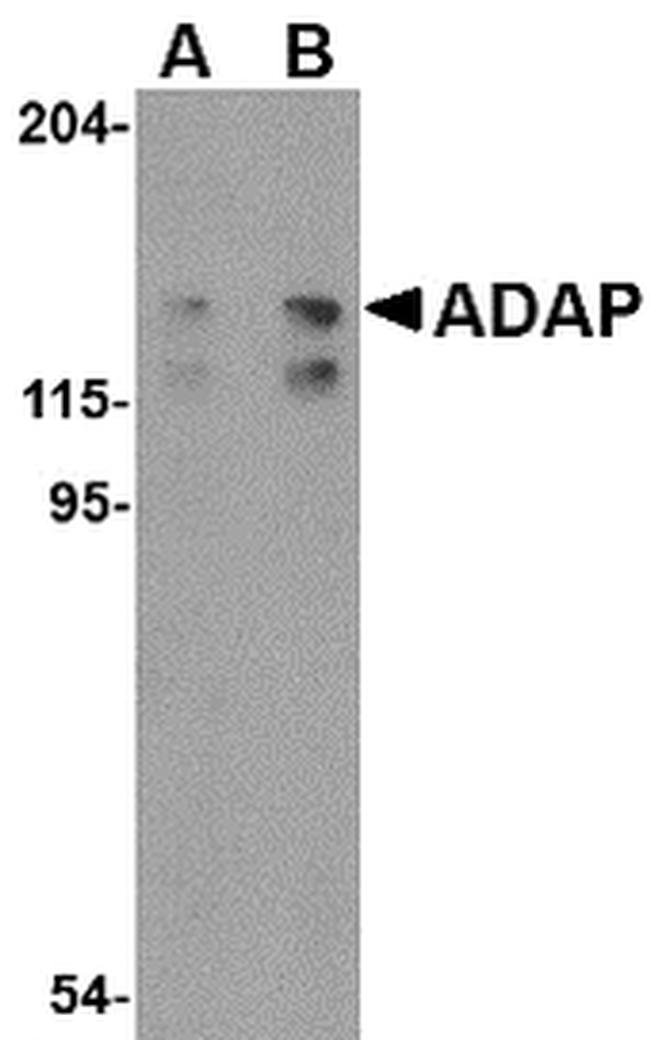 ADAP Antibody in Western Blot (WB)