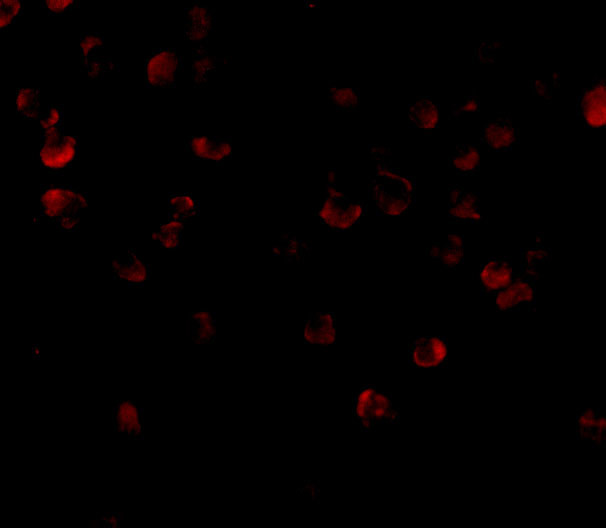 ADAP Antibody in Immunocytochemistry (ICC/IF)